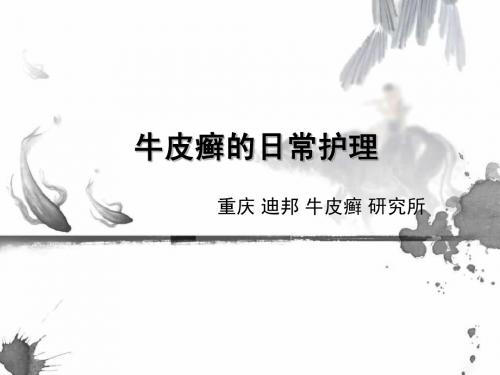 牛皮癣日常护理