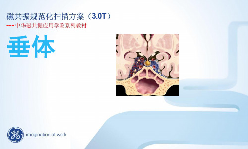垂体规范化扫描方案