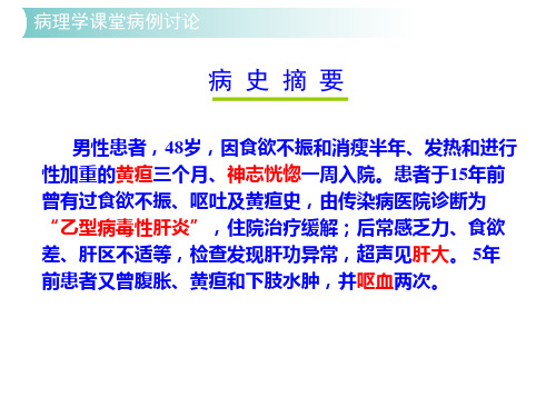 病理学病例讨论慢性肝炎—肝硬化—肝癌ppt课件