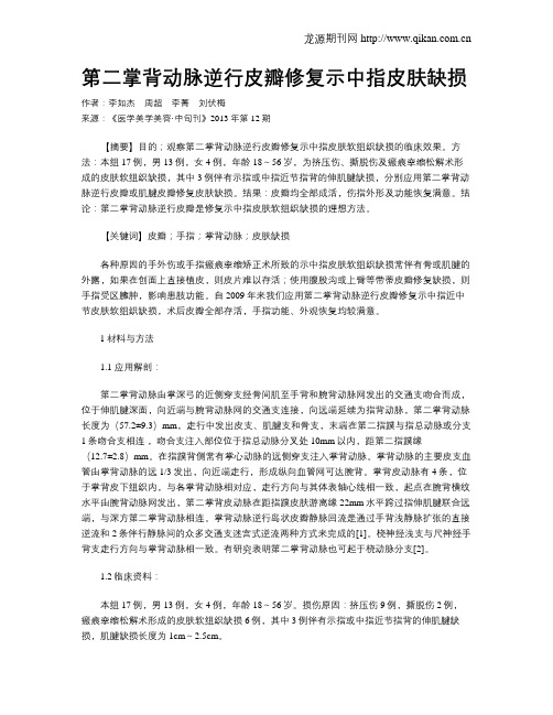 第二掌背动脉逆行皮瓣修复示中指皮肤缺损