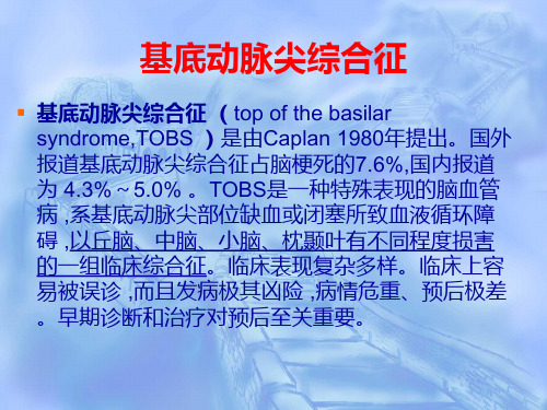 基底动脉尖综合症