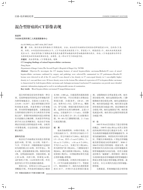 混合型肝癌的CT影像表现