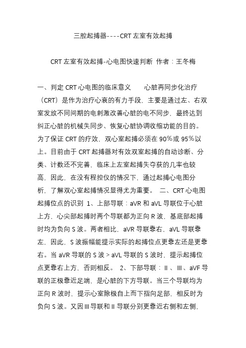 三腔起搏器----CRT左室有效起搏