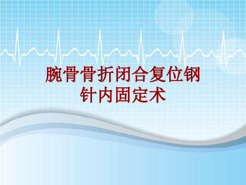 手术讲解模板：腕骨骨折闭合复位钢针内固定术