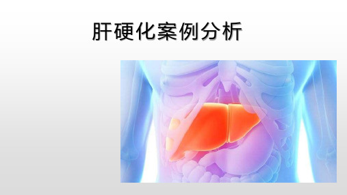 肝硬化案例分析+0929版