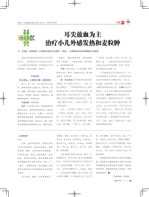 耳尖放血为主治疗小儿外感发热和麦粒肿