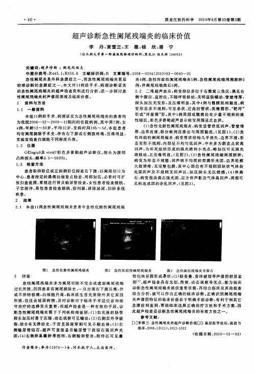 超声诊断急性阑尾残端炎的临床价值