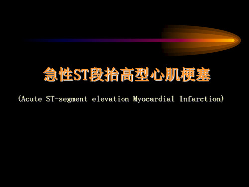 心肌梗塞