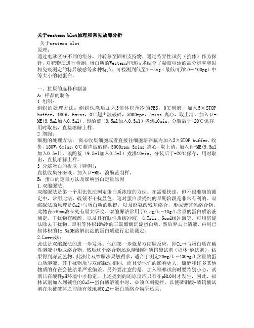 关于western blot原理和常见故障分析