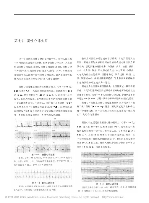 临床实用心电图入门  第七讲  窦性心律失常