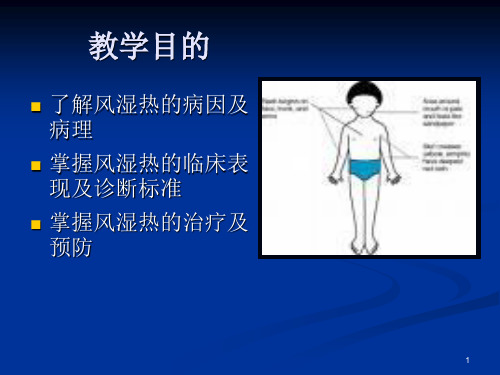 儿科学课件ppt风湿热