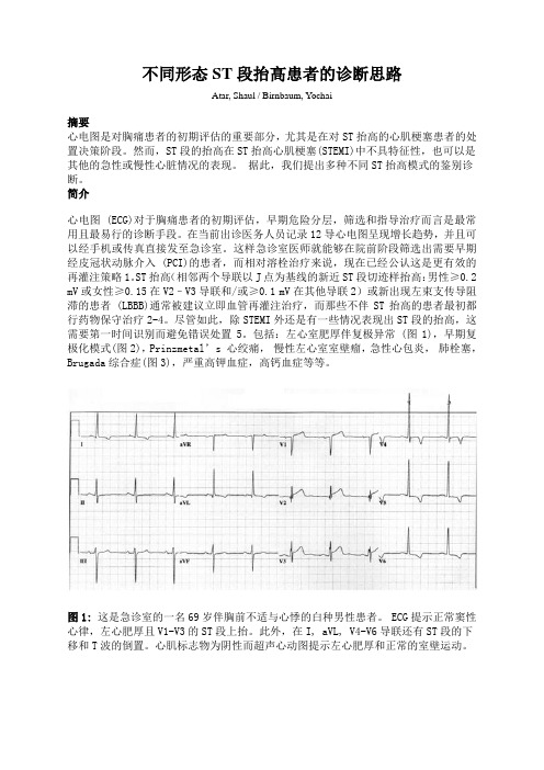不同形态ST段抬高患者的诊断思路