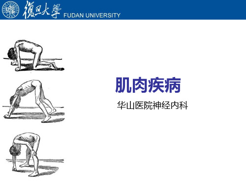 肌肉疾病疾病