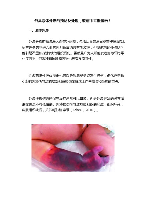 各类液体外渗的预防及处理，收藏下来慢慢看！