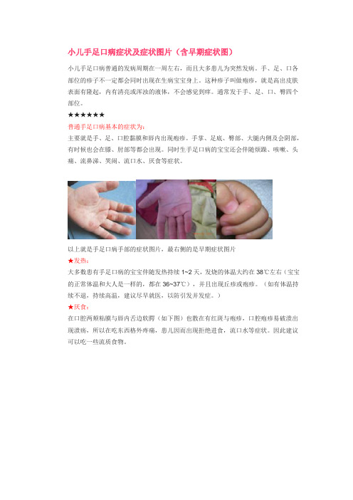 小儿手足口病症状及症状图片复习过程