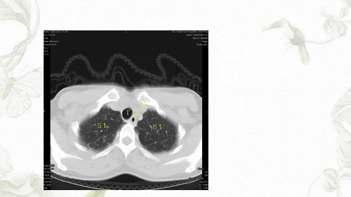 胸部CTppt课件