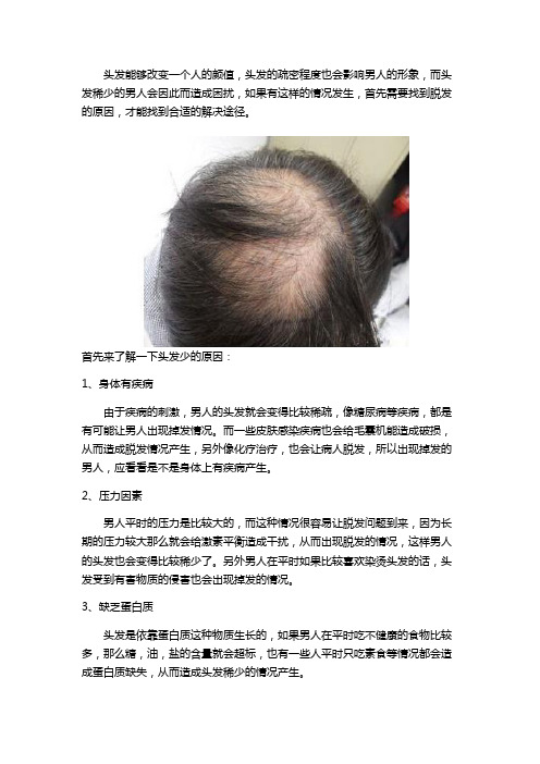男人头发稀少怎么办