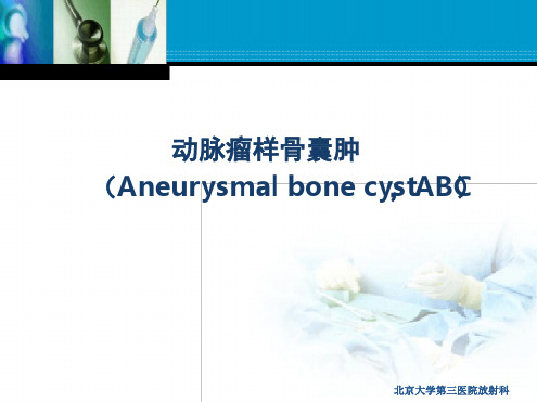 动脉瘤样骨囊肿