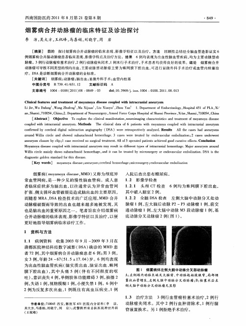 烟雾病合并动脉瘤的临床特征及诊治探讨