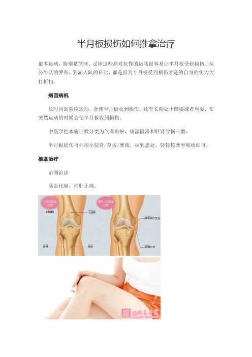 半月板损伤如何治疗(推拿篇)