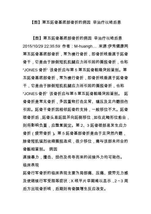 【图】第五跖骨基底部骨折的病因 早治疗以绝后患