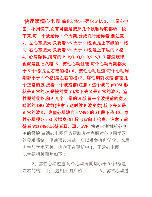 手把手教你读心电图(图解)