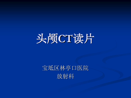 【源版】头颅CT基本知识