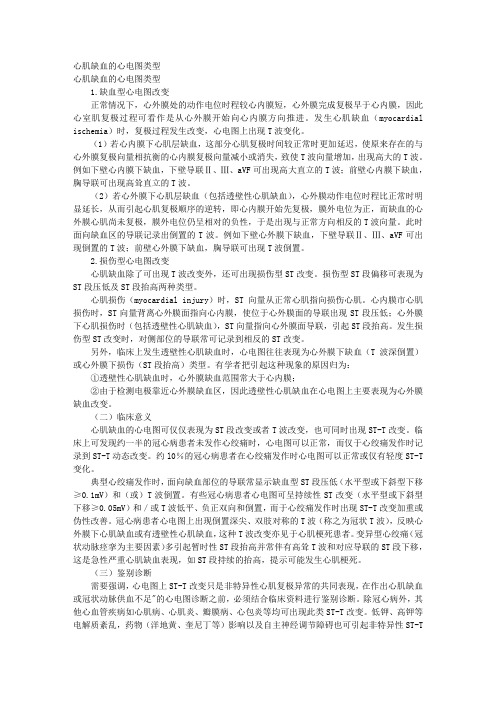 心肌缺血的心电图类型 