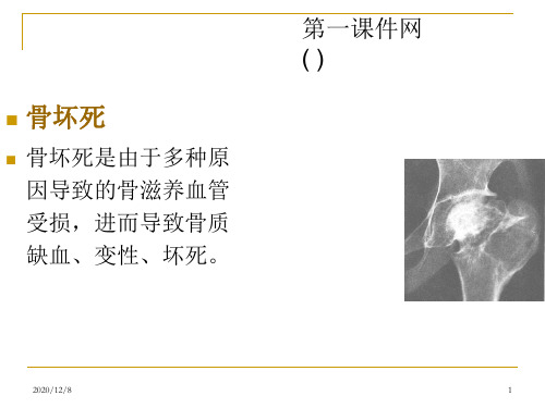 中医骨病学骨坏死精品PPT教学课件