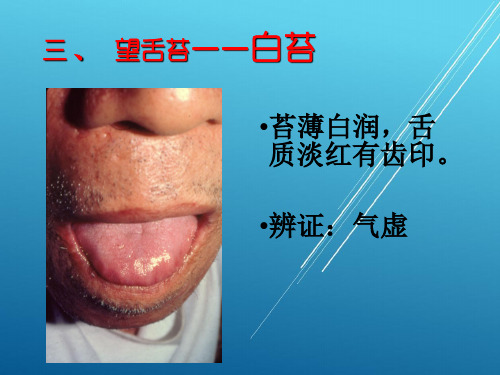 中医基础理论+四诊：望诊舌诊图谱