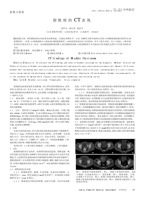 膀胱癌的CT表现