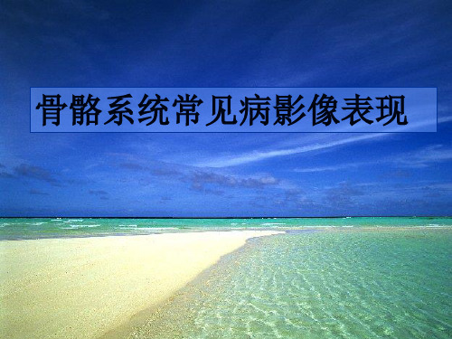 影像诊断学课件：骨骼系统常见病影像表现