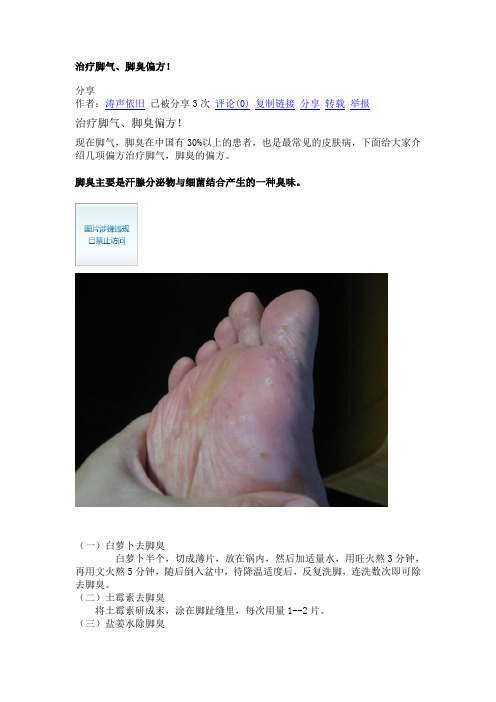 治疗脚气