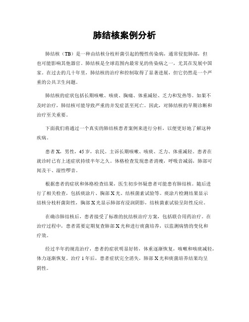 肺结核案例分析
