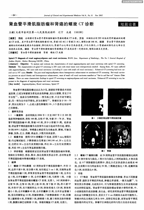 肾血管平滑肌脂肪瘤和肾癌的螺旋CT诊断