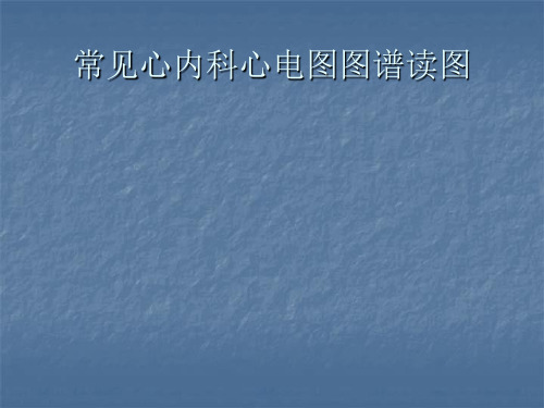 心内科常用心电图图谱读图