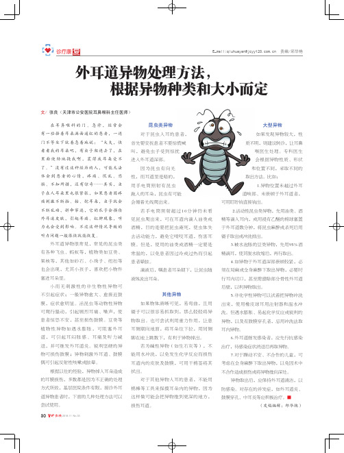 外耳道异物处理方法,根据异物种类和大小而定