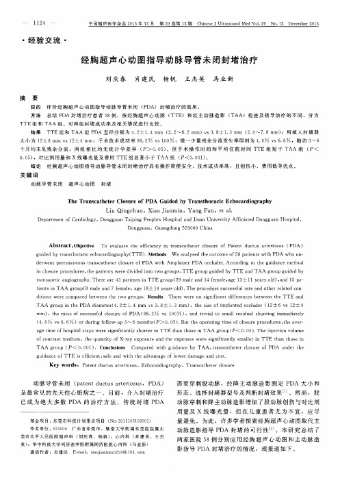 经胸超声心动图指导动脉导管未闭封堵治疗