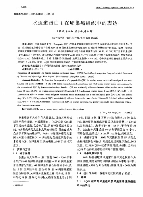 水通道蛋白1在卵巢癌组织中的表达