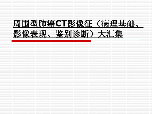 周围型肺癌CT影像