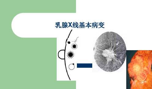 乳腺X线基本病变