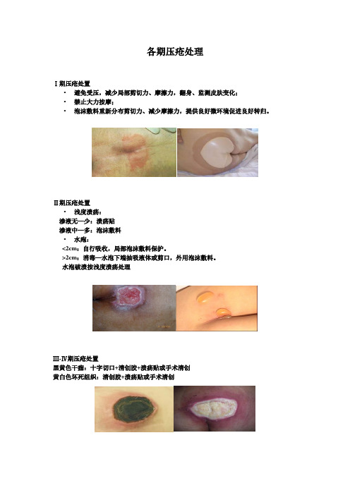 各期压疮处理建议