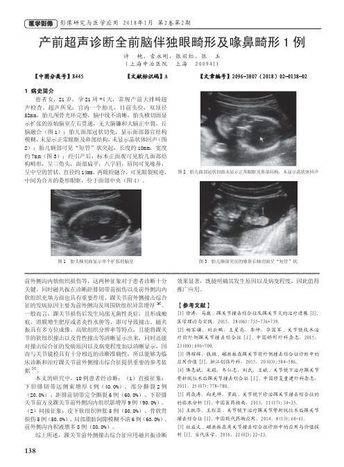 产前超声诊断全前脑伴独眼畸形及喙鼻畸形1例