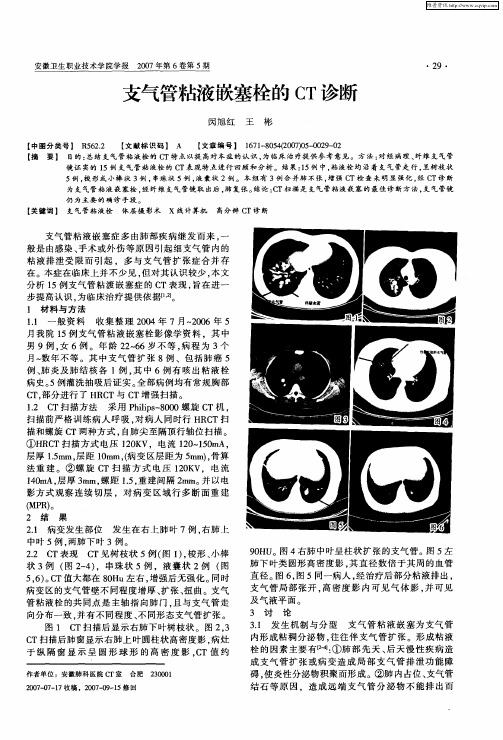 支气管粘液嵌塞栓的CT诊断