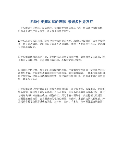 冬季牛皮癣加重的表现 带来多种并发症