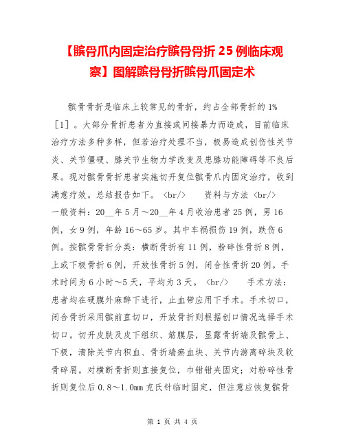 【髌骨爪内固定治疗髌骨骨折25例临床观察】图解髌骨骨折髌骨爪固定术