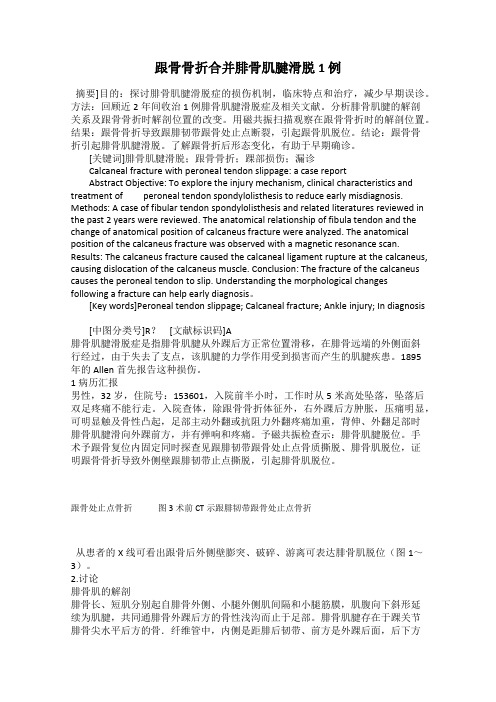 跟骨骨折合并腓骨肌腱滑脱 1 例