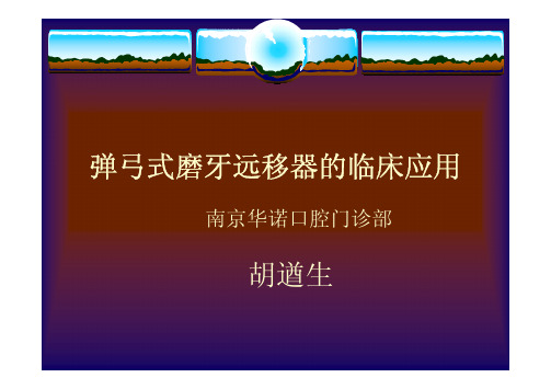 弹弓式磨牙远移器(1)