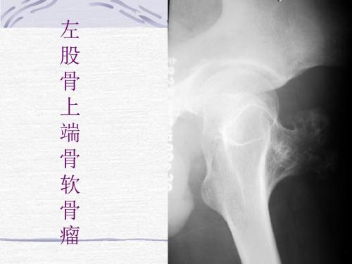骨肿瘤X线病例图谱 PPT课件