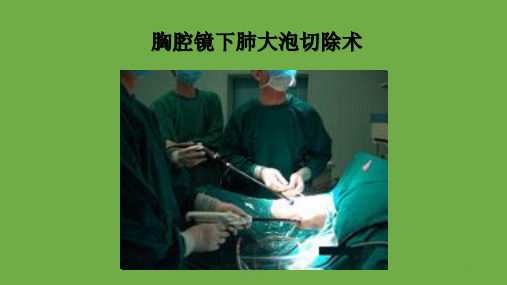 胸腔镜下肺大泡切除术(研究荟萃)